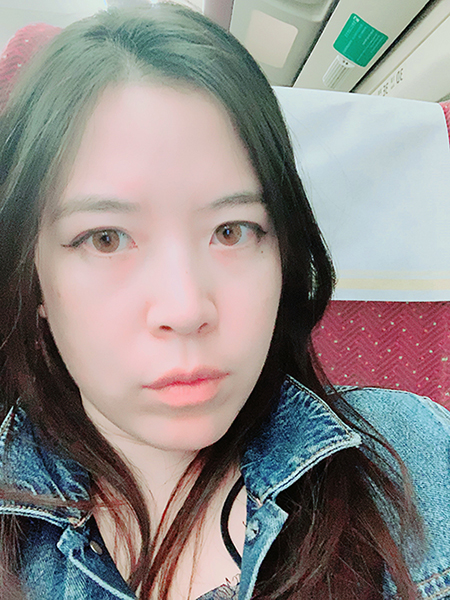 中醫減重 大腿埋線